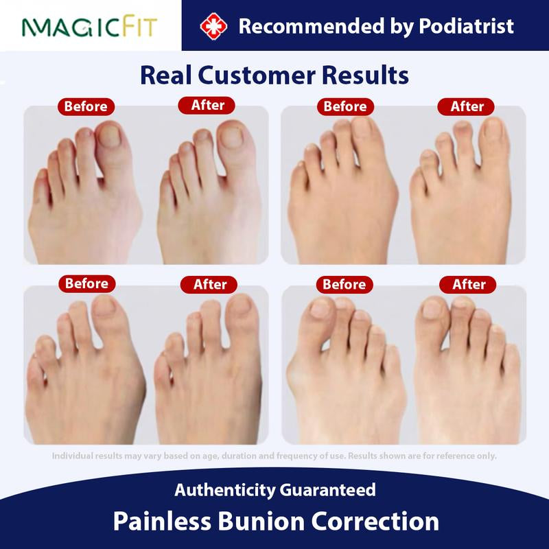 Magicfit Bunion Relief: Comfortable and Durable Support for Walking, Running, and Hiking Footwear